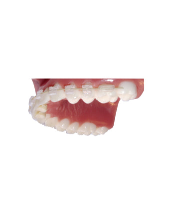 Bite Bumper™ – Ansicht 1
