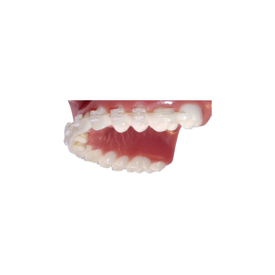 Bite Bumper™ – Ansicht 1