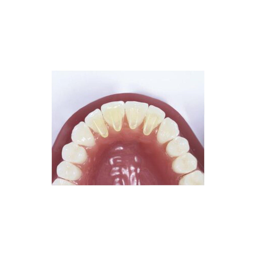 Mini Mold™ – Ansicht 2