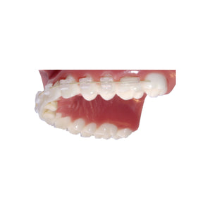 Bite Bumper™